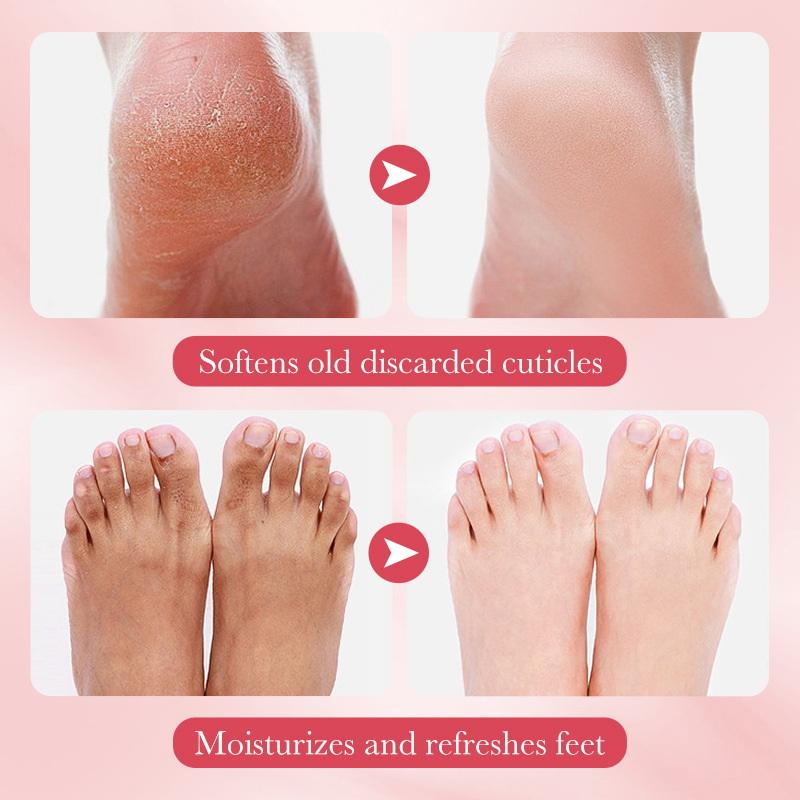 Skincare Exfoliating - 1 paar SADOER Fruit Voetmasker Hydraterend