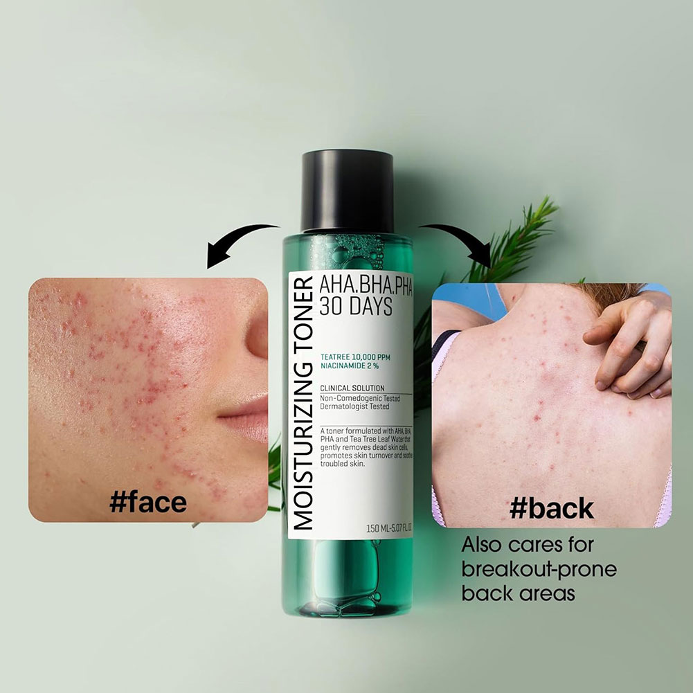Some by Mi Aha.Bha.Pha 30 Days - Skincare Some By Mi recensie en prijs